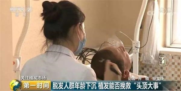 脱发人群超2.5亿