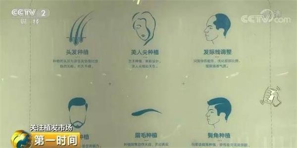 脱发人群超2.5亿