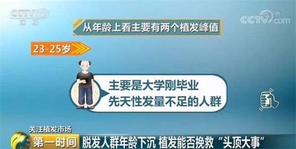 脱发人群超2.5亿