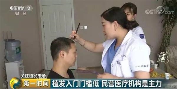 脱发人群超2.5亿