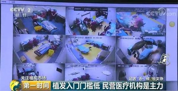 脱发人群超2.5亿